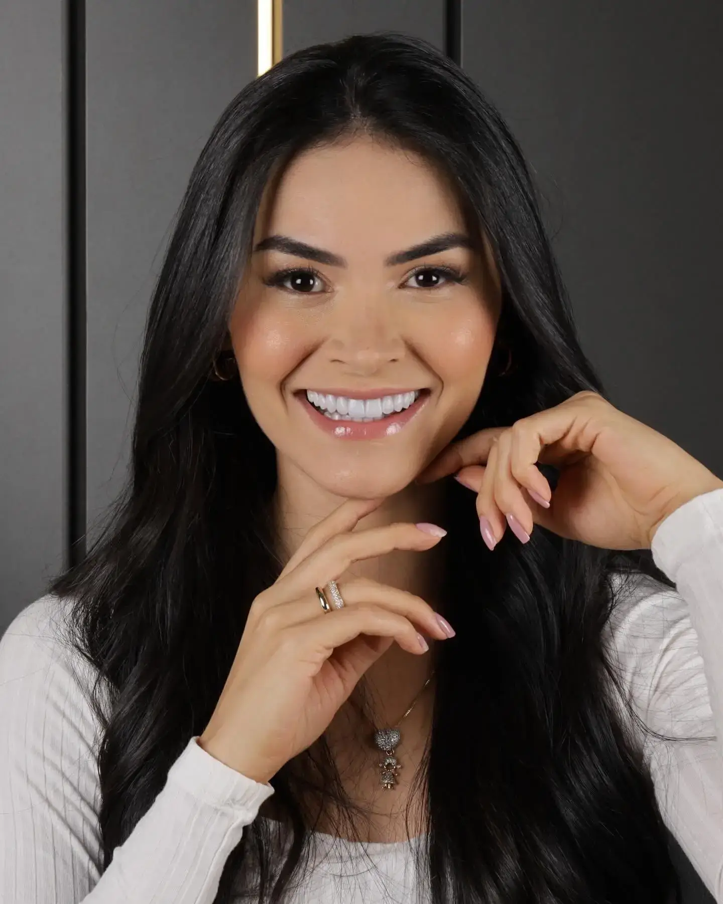 Resultado do tratamento: Lentes de contato em porcelana de alta tecnologia