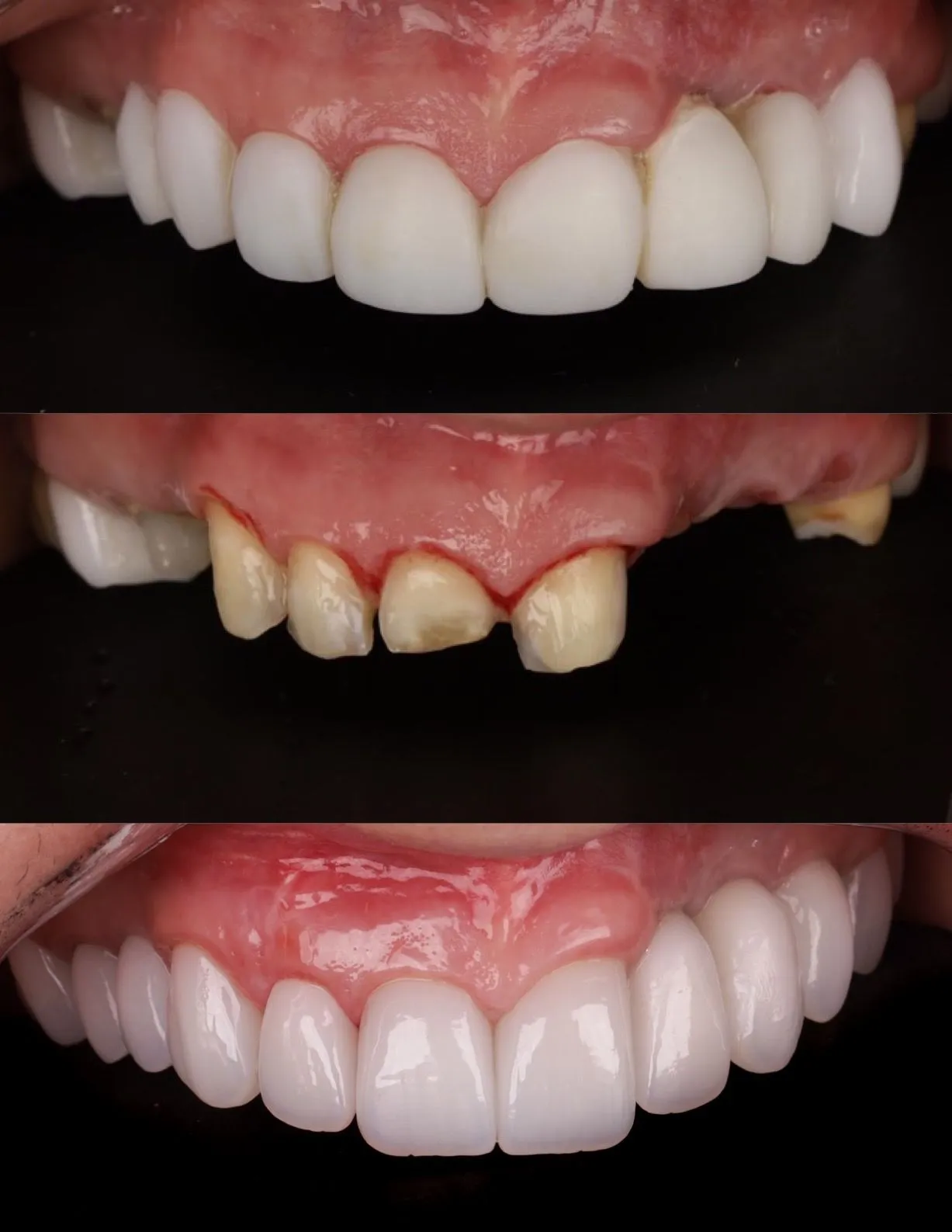 Resultado do tratamento: Reabicitações Complexas